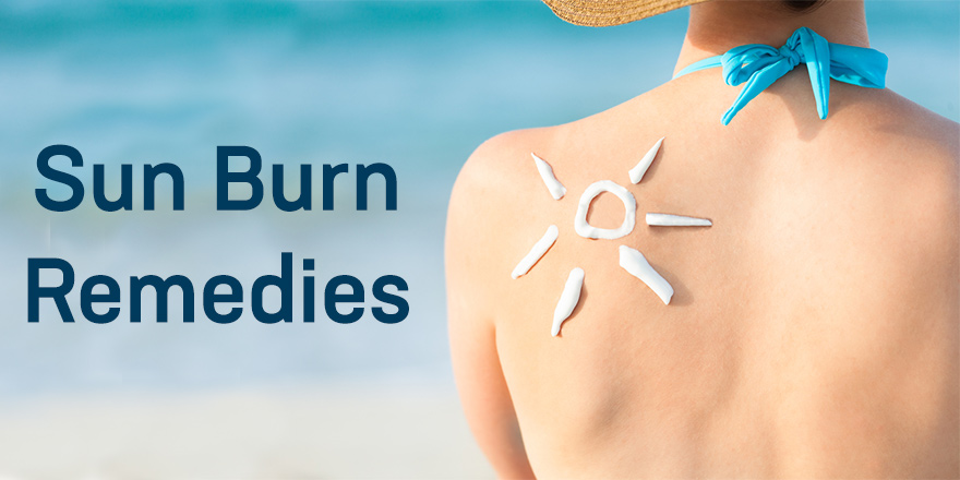 Sunburn Remedies: Take the 